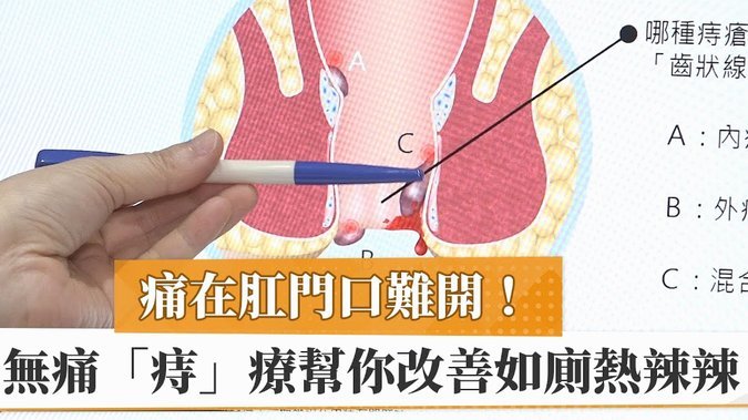 乔迪：有机会踢成7-4；可以问问山东教练他们防守漏洞在哪